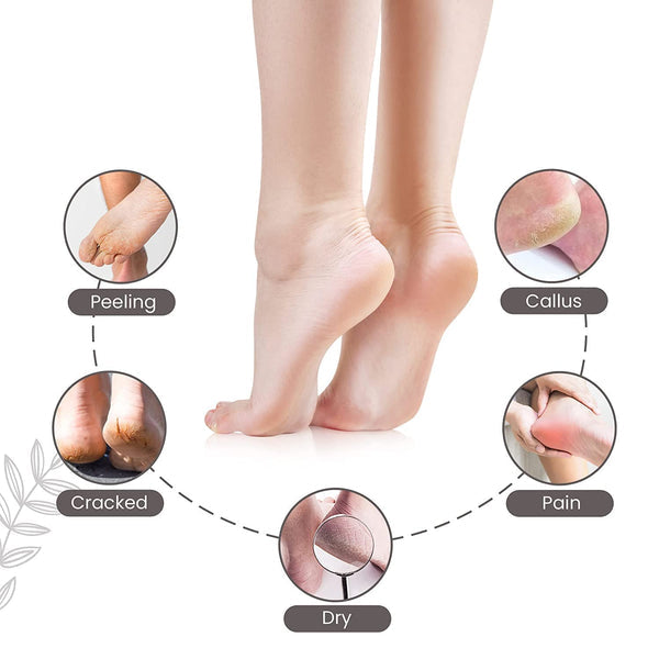 Callus Remover for Feet | 1 Year Warranty | Foot Scrubber for Dead Skin, 3 Changeable Roller Heads, Foot Scrubber, Feet Dead Skin Remover, Pedicure Machine with Adapter